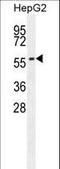 Coenzyme Q8A antibody, LS-C168251, Lifespan Biosciences, Western Blot image 