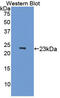 Microtubule Associated Protein 4 antibody, MBS2027085, MyBioSource, Western Blot image 