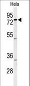 CLPTM1 Regulator Of GABA Type A Receptor Forward Trafficking antibody, LS-C168853, Lifespan Biosciences, Western Blot image 