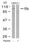 RB Transcriptional Corepressor 1 antibody, 79-546, ProSci, Western Blot image 