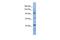 RNA Binding Motif Protein 12 antibody, GTX47351, GeneTex, Western Blot image 