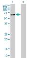 Acyl-CoA Synthetase Short Chain Family Member 2 antibody, H00055902-B01P, Novus Biologicals, Western Blot image 