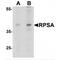 Ribosomal Protein SA antibody, MBS153619, MyBioSource, Western Blot image 