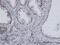 Extra Spindle Pole Bodies Like 1, Separase antibody, H00009700-M01, Novus Biologicals, Immunohistochemistry paraffin image 