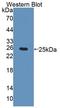 Cholinergic Receptor Nicotinic Alpha 4 Subunit antibody, LS-C374263, Lifespan Biosciences, Western Blot image 