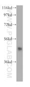 Histone Deacetylase 8 antibody, 17548-1-AP, Proteintech Group, Western Blot image 