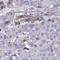 Cyclin Dependent Kinase Like 1 antibody, NBP2-32482, Novus Biologicals, Immunohistochemistry frozen image 