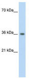 Phytanoyl-CoA 2-Hydroxylase Interacting Protein antibody, TA334678, Origene, Western Blot image 