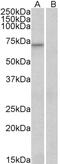 Forkhead Box O3 antibody, 45-054, ProSci, Enzyme Linked Immunosorbent Assay image 