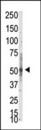 Protein Arginine Methyltransferase 3 antibody, 55-021, ProSci, Western Blot image 