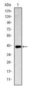 Killer Cell Lectin Like Receptor D1 antibody, AM06586SU-N, Origene, Western Blot image 