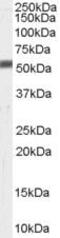 Zinc Metallopeptidase STE24 antibody, PA5-18579, Invitrogen Antibodies, Western Blot image 