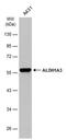 Aldehyde Dehydrogenase 1 Family Member A3 antibody, MA5-27727, Invitrogen Antibodies, Western Blot image 