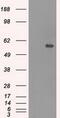 CNDP1 antibody, GTX84677, GeneTex, Western Blot image 