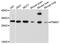 Proteasome Subunit Alpha 7 antibody, A05091, Boster Biological Technology, Western Blot image 