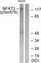 Nuclear Factor Of Activated T Cells 4 antibody, PA5-38302, Invitrogen Antibodies, Western Blot image 