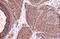 Thymidine Kinase 1 antibody, NBP2-20626, Novus Biologicals, Immunohistochemistry paraffin image 