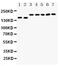 DCC Netrin 1 Receptor antibody, PA5-79139, Invitrogen Antibodies, Western Blot image 