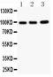 Erythrocyte Membrane Protein Band 4.1 Like 1 antibody, PB9179, Boster Biological Technology, Western Blot image 