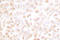 Cyclin Dependent Kinase 2 antibody, LS-C175953, Lifespan Biosciences, Immunohistochemistry paraffin image 