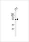 Ankyrin Repeat Domain 13C antibody, PA5-72668, Invitrogen Antibodies, Western Blot image 