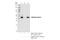 SWI/SNF Related, Matrix Associated, Actin Dependent Regulator Of Chromatin, Subfamily B, Member 1 antibody, 91735S, Cell Signaling Technology, Immunoprecipitation image 