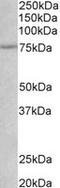 Nerve Growth Factor Receptor antibody, MBS422760, MyBioSource, Western Blot image 