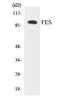 FES Proto-Oncogene, Tyrosine Kinase antibody, EKC1670, Boster Biological Technology, Western Blot image 