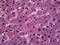 Orosomucoid 1 antibody, 51-778, ProSci, Immunohistochemistry paraffin image 