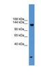 SIK Family Kinase 3 antibody, NBP1-69207, Novus Biologicals, Western Blot image 