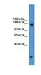 Serine/threonine-protein kinase SIK3 antibody, NBP1-69207, Novus Biologicals, Western Blot image 