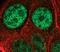 Proteasome Activator Subunit 3 antibody, PA5-17333, Invitrogen Antibodies, Immunofluorescence image 