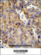 Collagen Type XVIII Alpha 1 Chain antibody, 55-358, ProSci, Immunohistochemistry paraffin image 