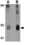 Wnt Family Member 10B antibody, GTX17006, GeneTex, Western Blot image 