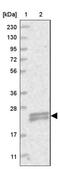 TMEM9 Domain Family Member B antibody, NBP1-88545, Novus Biologicals, Western Blot image 