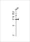 Tyrosine 3-Monooxygenase/Tryptophan 5-Monooxygenase Activation Protein Gamma antibody, LS-C160699, Lifespan Biosciences, Western Blot image 