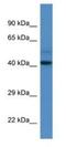 DDB1- and CUL4-associated factor 7 antibody, NBP1-74157, Novus Biologicals, Western Blot image 