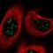 TBC1 Domain Family Member 13 antibody, PA5-61110, Invitrogen Antibodies, Immunofluorescence image 