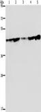 Ceramide Synthase 4 antibody, TA351343, Origene, Western Blot image 