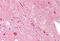 Myogenic factor 5 antibody, MBS248130, MyBioSource, Immunohistochemistry frozen image 