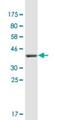 Collagen Type XXI Alpha 1 Chain antibody, H00081578-M01, Novus Biologicals, Western Blot image 