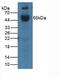 Interleukin 1 Receptor Type 1 antibody, MBS2027960, MyBioSource, Western Blot image 