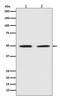 Pygopus Family PHD Finger 2 antibody, M05260, Boster Biological Technology, Western Blot image 