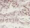 Cullin-4A antibody, FNab02076, FineTest, Immunohistochemistry paraffin image 