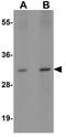 Vesicle Associated Membrane Protein 7 antibody, GTX17175, GeneTex, Western Blot image 