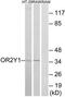 Olfactory Receptor Family 2 Subfamily Y Member 1 antibody, TA316107, Origene, Western Blot image 