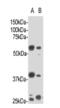 Ceramide Synthase 2 antibody, MBS857572, MyBioSource, Western Blot image 