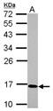 Chromosome 17 Open Reading Frame 49 antibody, NBP2-15546, Novus Biologicals, Western Blot image 