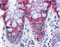 Epithelial Stromal Interaction 1 antibody, 51-599, ProSci, Immunohistochemistry paraffin image 