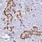 U1 small nuclear ribonucleoprotein A antibody, HPA046440, Atlas Antibodies, Immunohistochemistry frozen image 
